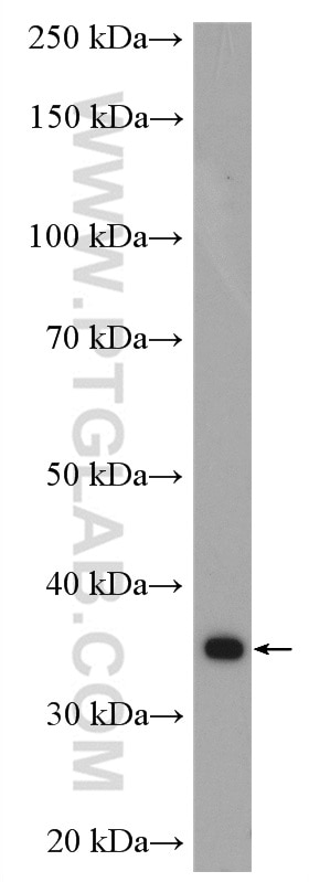 Western Blot (WB) analysis of A431 cells using CDK1-Specific Polyclonal antibody (19532-1-AP)