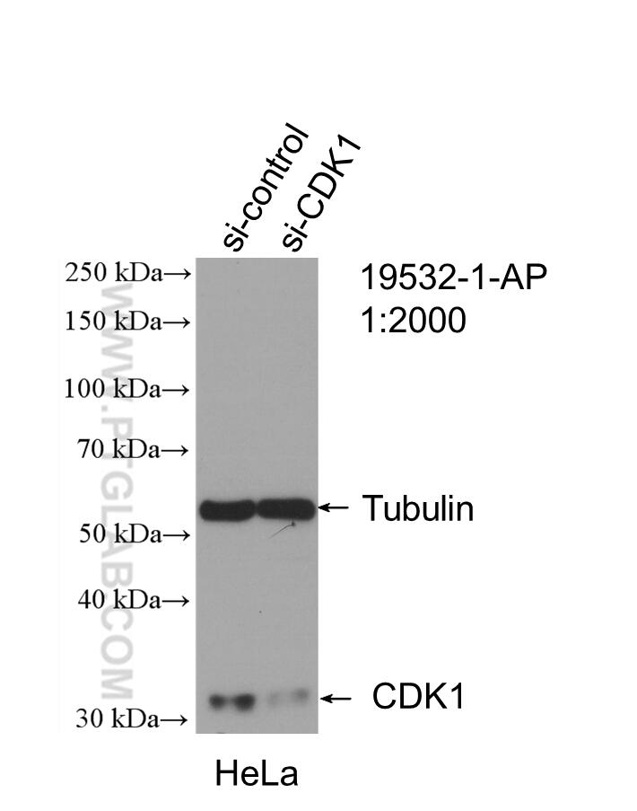 Western Blot (WB) analysis of HeLa cells using CDK1-Specific Polyclonal antibody (19532-1-AP)