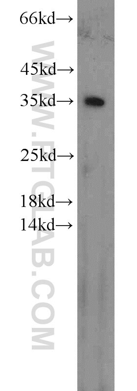 Western Blot (WB) analysis of MCF-7 cells using CDK1-Specific Polyclonal antibody (19532-1-AP)