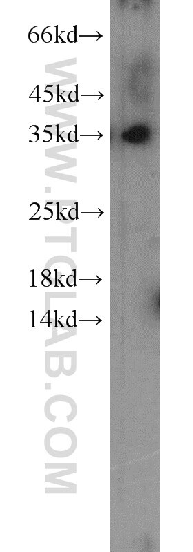 Western Blot (WB) analysis of HEK-293 cells using CDK1-Specific Polyclonal antibody (19532-1-AP)