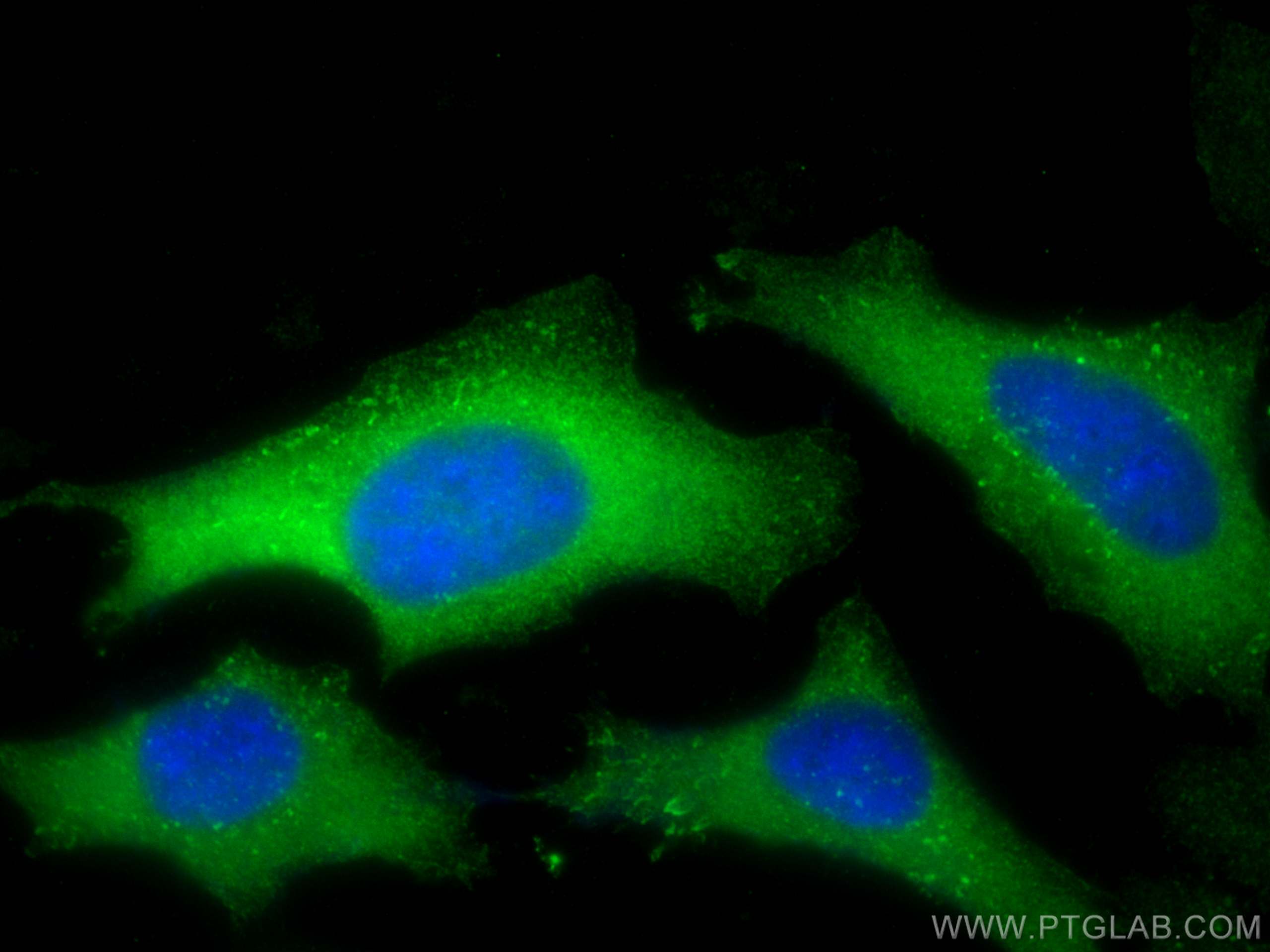 Immunofluorescence (IF) / fluorescent staining of HeLa cells using Cdc20 Polyclonal antibody (10252-1-AP)