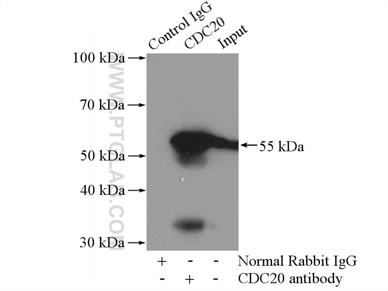 Immunoprecipitation (IP) experiment of Jurkat cells using Cdc20 Polyclonal antibody (10252-1-AP)