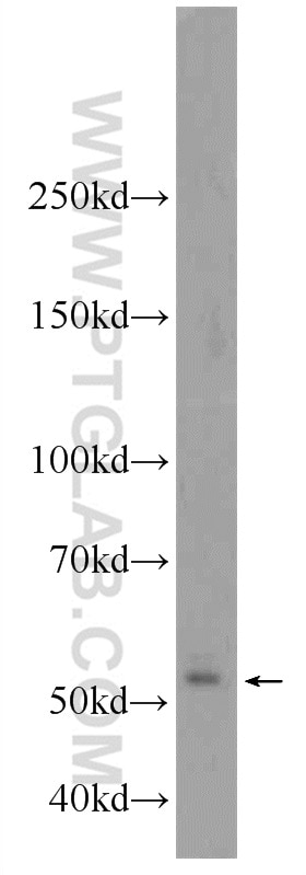 Western Blot (WB) analysis of HL-60 cells using Cdc20 Polyclonal antibody (10252-1-AP)