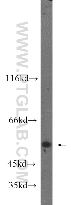 Western Blot (WB) analysis of PC-3 cells using Cdc20 Polyclonal antibody (10252-1-AP)