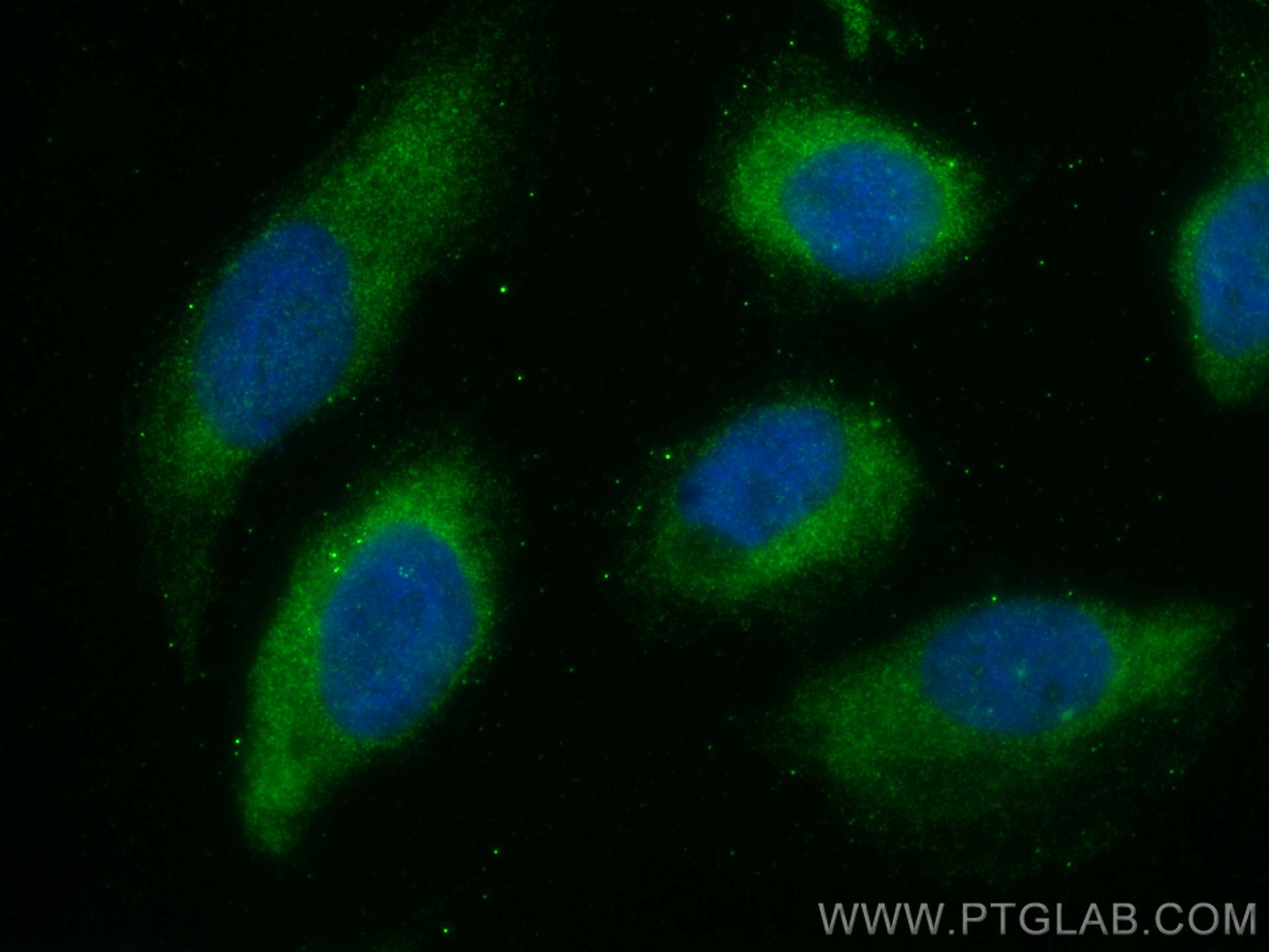 Immunofluorescence (IF) / fluorescent staining of U2OS cells using CDC20 Polyclonal antibody (30451-1-AP)