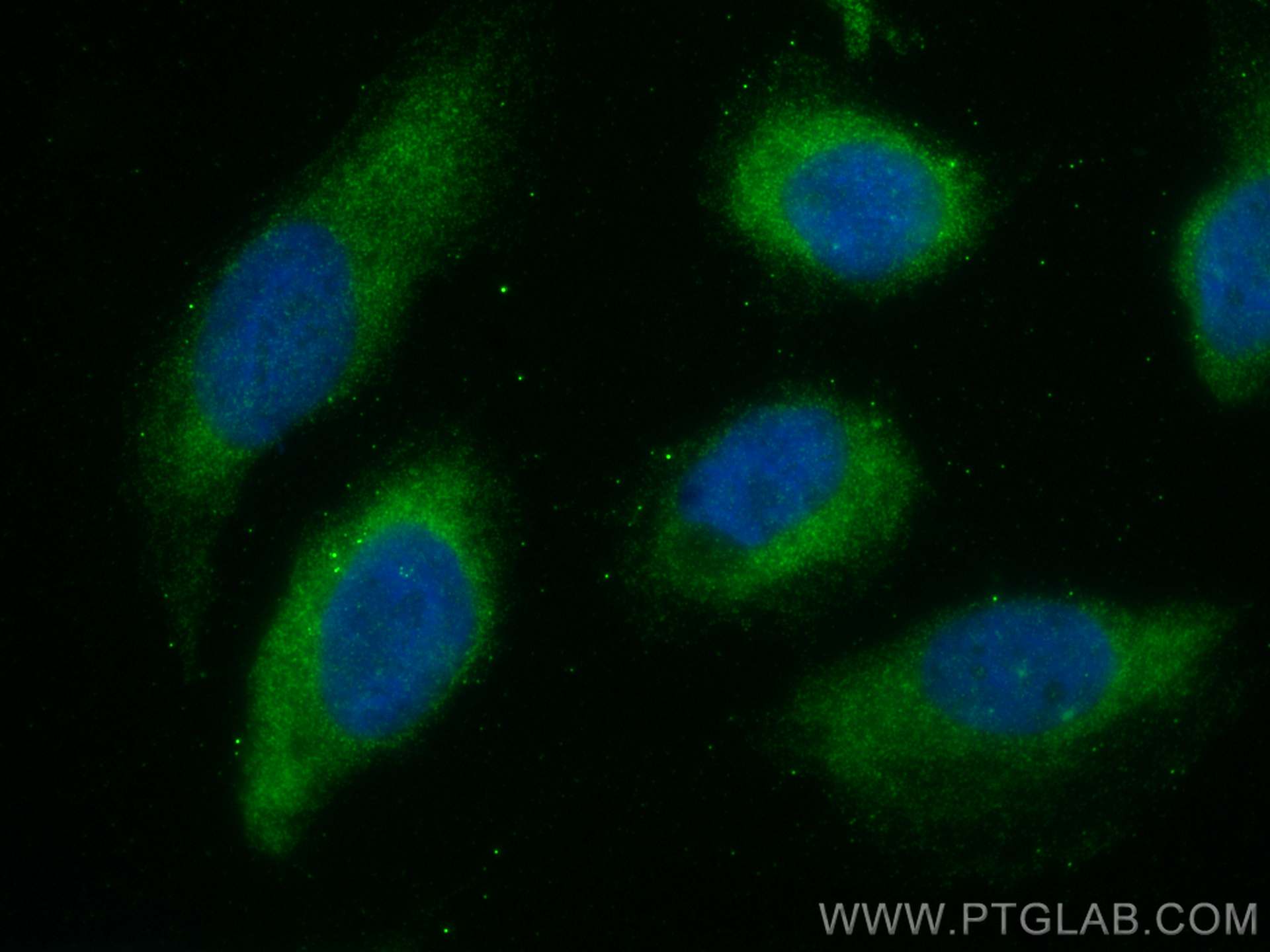 IF Staining of U2OS using 30451-1-AP