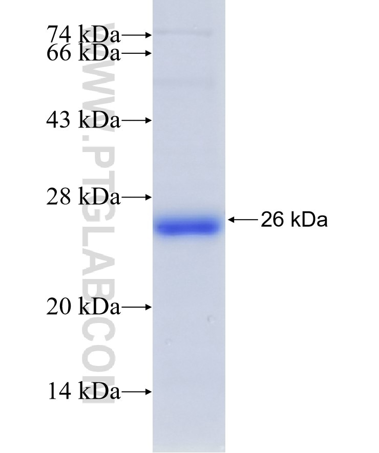 CDC20 fusion protein Ag32712 SDS-PAGE