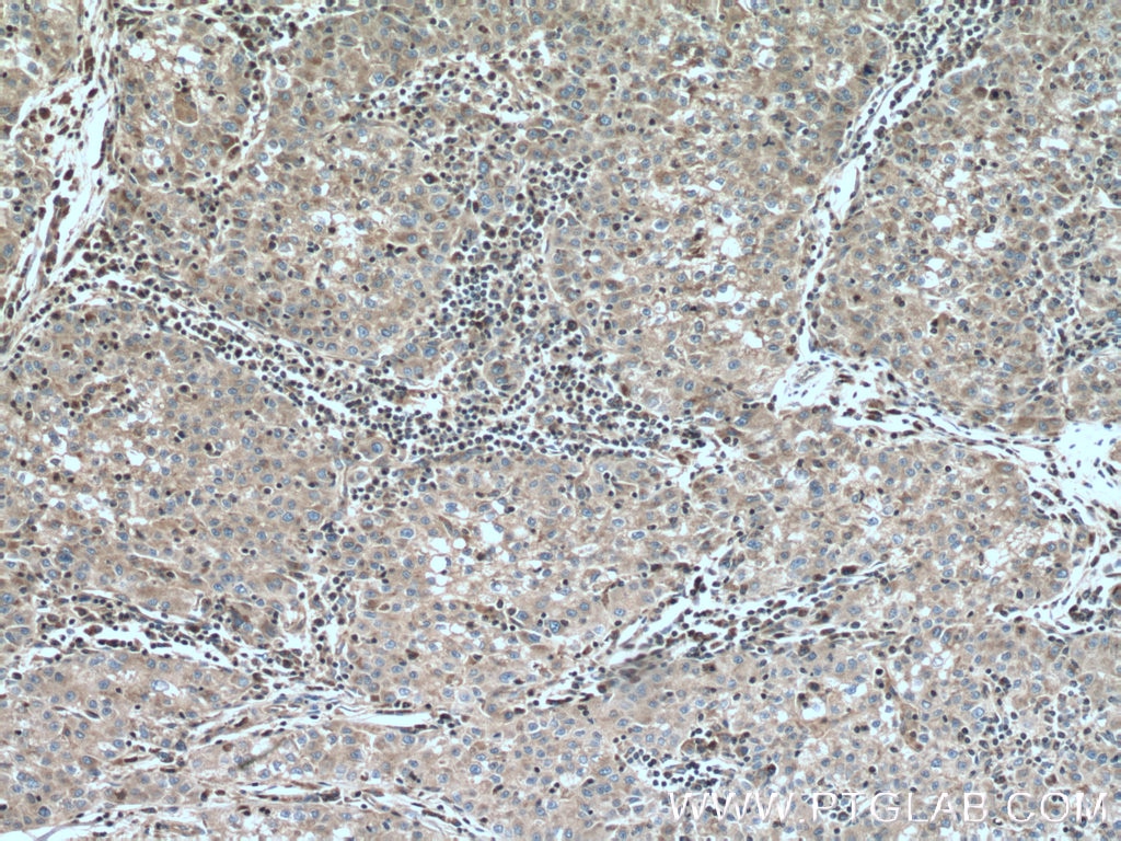 Immunohistochemistry (IHC) staining of human kidney tissue using CDC20B Polyclonal antibody (13376-1-AP)