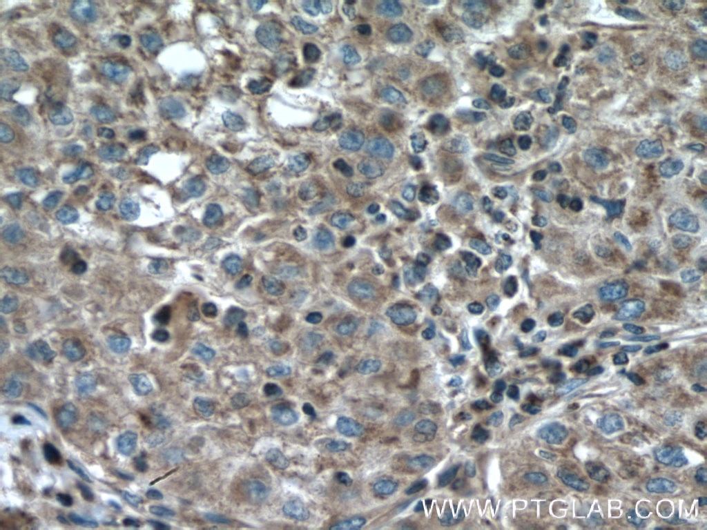 Immunohistochemistry (IHC) staining of human kidney tissue using CDC20B Polyclonal antibody (13376-1-AP)