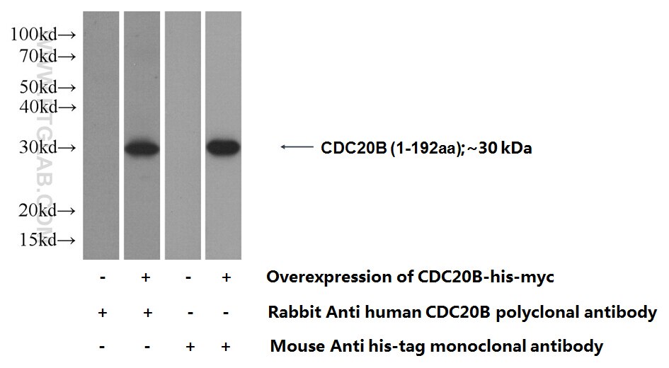 CDC20B