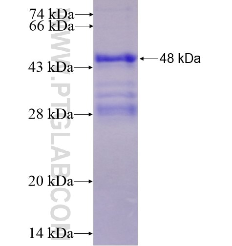 CDC20B fusion protein Ag4198 SDS-PAGE