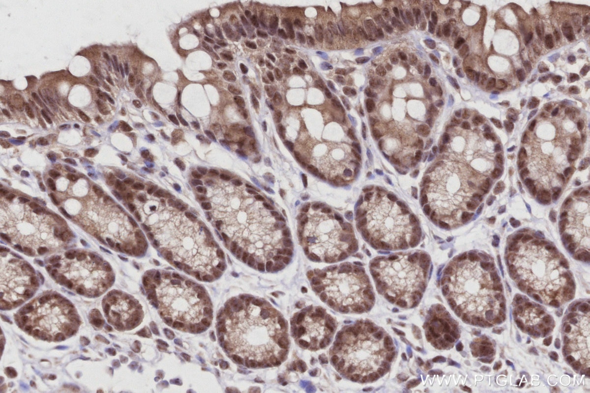 Immunohistochemistry (IHC) staining of mouse colon tissue using CDC23 Polyclonal antibody (10683-1-AP)