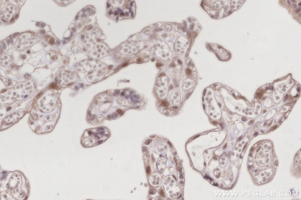 Immunohistochemistry (IHC) staining of human placenta tissue using CDC23 Polyclonal antibody (10683-1-AP)