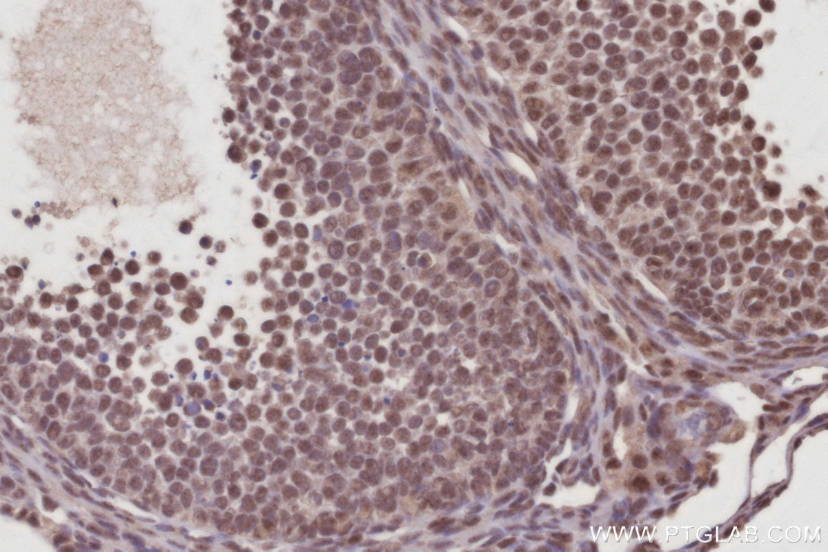 Immunohistochemistry (IHC) staining of mouse ovary tissue using CDC23 Polyclonal antibody (10683-1-AP)