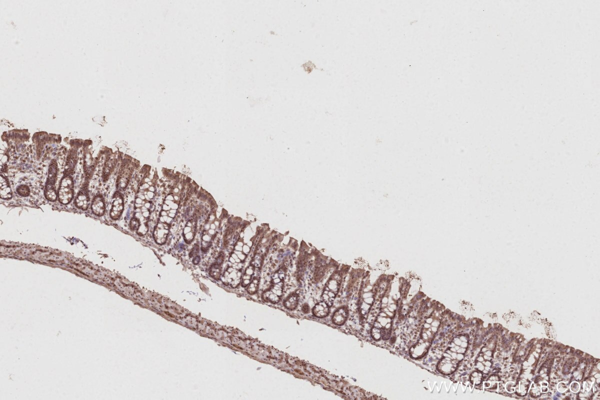 Immunohistochemistry (IHC) staining of rat colon tissue using CDC23 Polyclonal antibody (10683-1-AP)