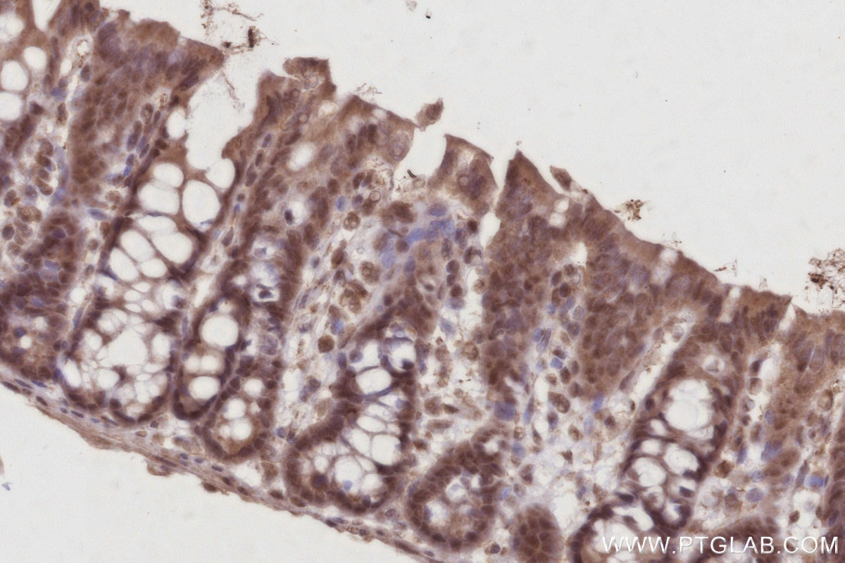 Immunohistochemistry (IHC) staining of rat colon tissue using CDC23 Polyclonal antibody (10683-1-AP)