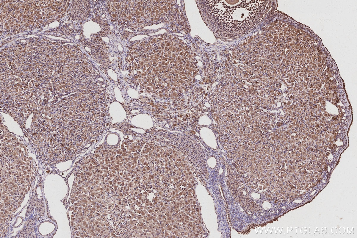 Immunohistochemistry (IHC) staining of rat ovary tissue using CDC23 Polyclonal antibody (10683-1-AP)