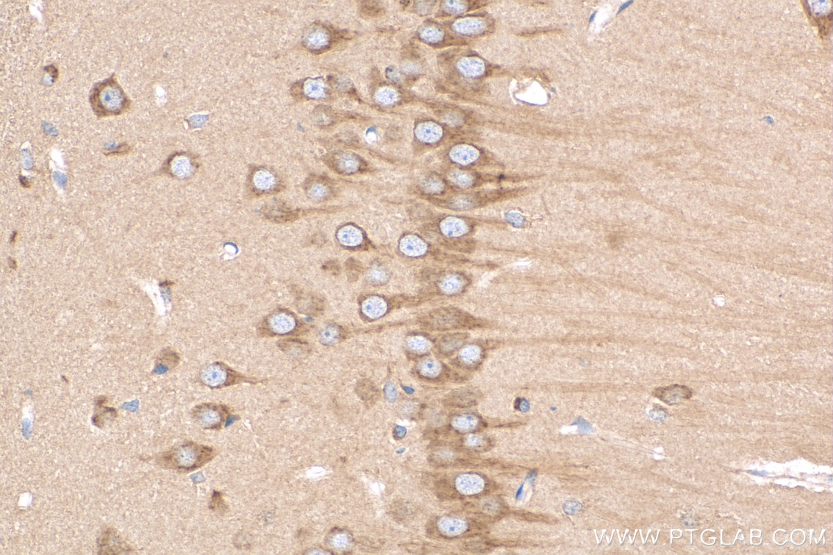 Immunohistochemistry (IHC) staining of rat brain tissue using RASGRF1 Polyclonal antibody (12958-1-AP)
