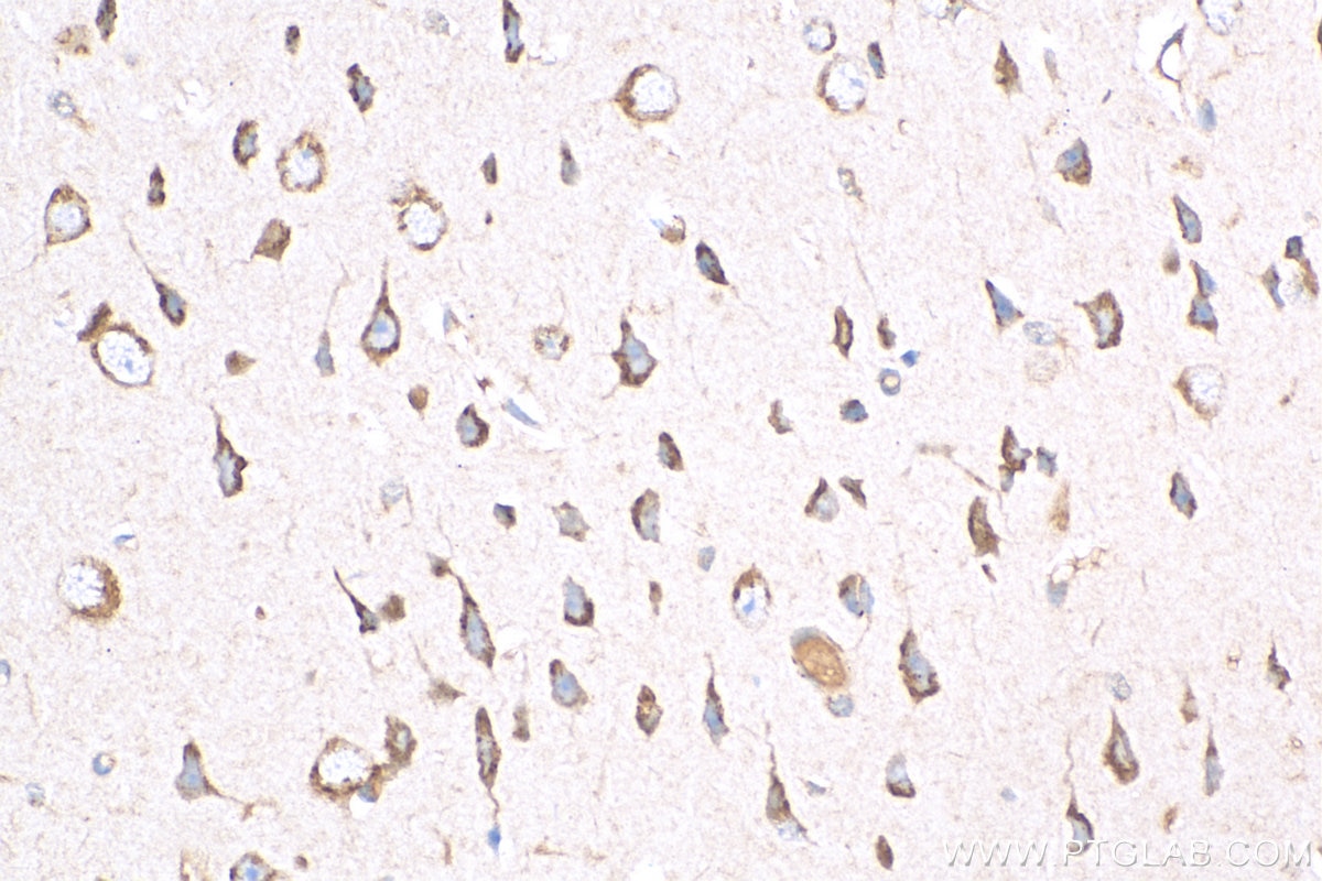 Immunohistochemistry (IHC) staining of mouse brain tissue using RASGRF1 Polyclonal antibody (12958-1-AP)