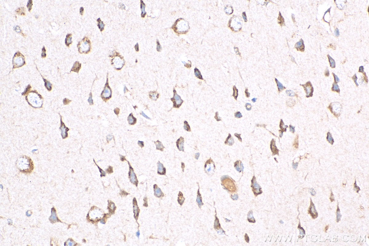 IHC staining of mouse brain using 12958-1-AP