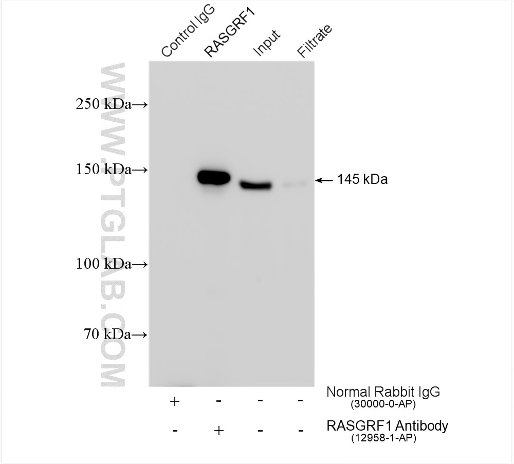 IP experiment of rat brain using 12958-1-AP