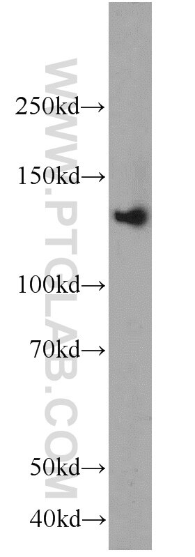 Western Blot (WB) analysis of rat brain tissue using RASGRF1 Polyclonal antibody (12958-1-AP)