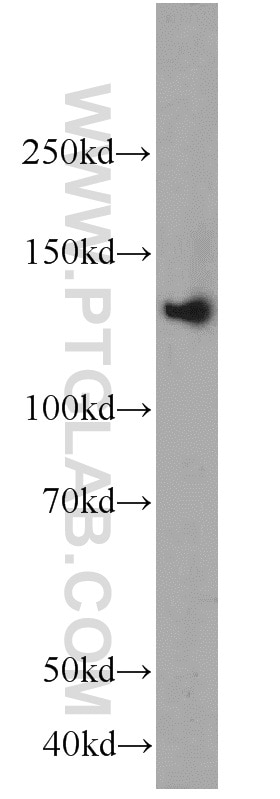 WB analysis of rat brain using 12958-1-AP