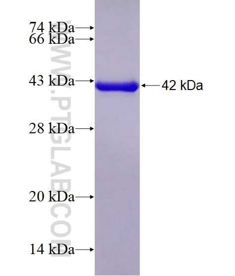 RASGRF1 fusion protein Ag6937 SDS-PAGE