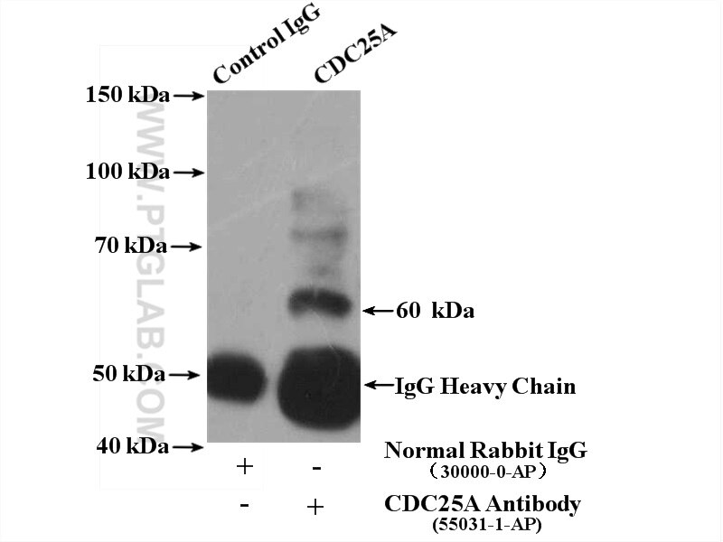 Immunoprecipitation (IP) experiment of HeLa cells using CDC25A Polyclonal antibody (55031-1-AP)