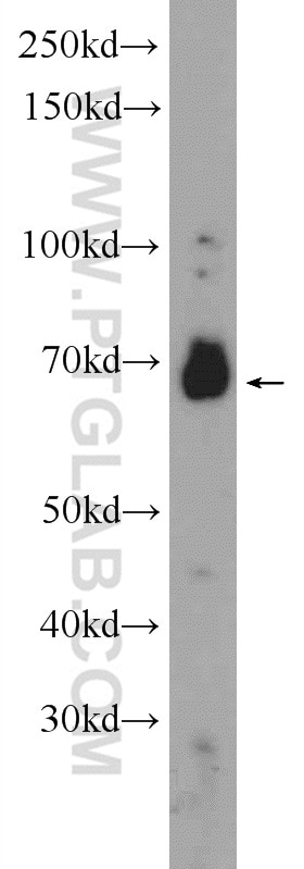 Western Blot (WB) analysis of mouse liver tissue using CDC25A Polyclonal antibody (55031-1-AP)