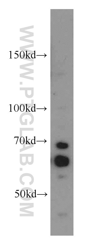 Western Blot (WB) analysis of HepG2 cells using CDC25A Polyclonal antibody (55031-1-AP)