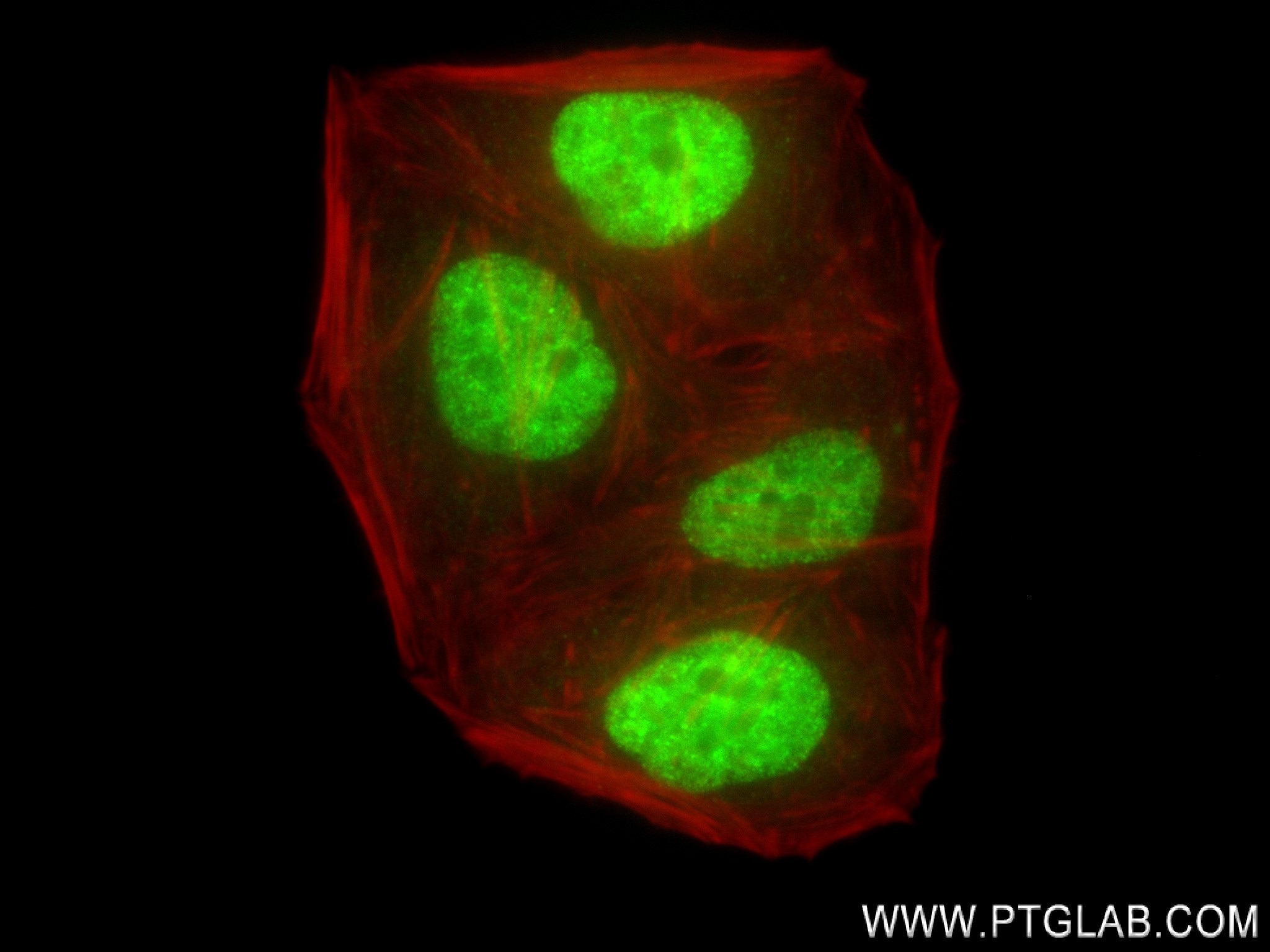 Immunofluorescence (IF) / fluorescent staining of HepG2 cells using CDC25A Recombinant antibody (84145-2-RR)