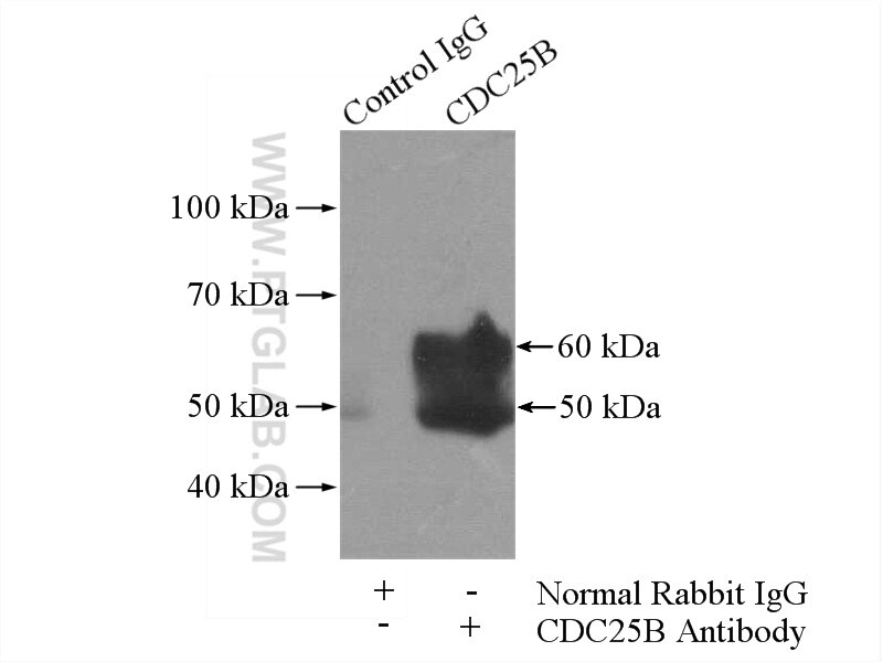 Immunoprecipitation (IP) experiment of mouse liver tissue using CDC25B Polyclonal antibody (10644-1-AP)