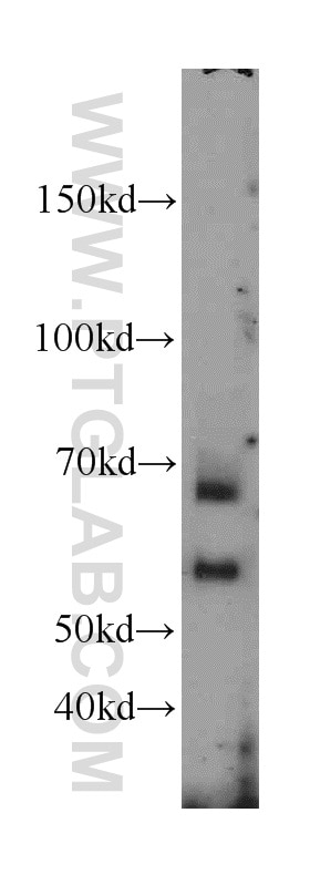 Western Blot (WB) analysis of Jurkat cells using CDC25B Polyclonal antibody (10644-1-AP)