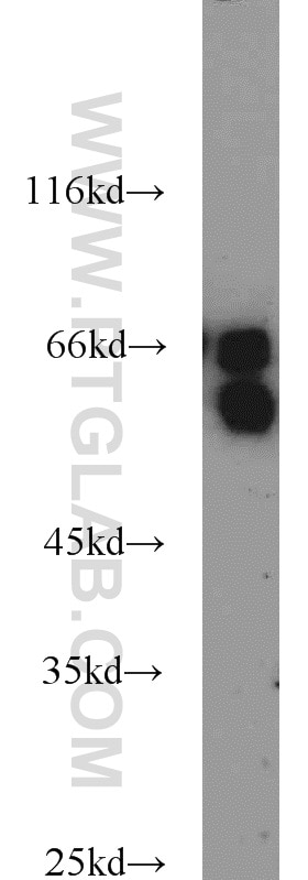 Western Blot (WB) analysis of mouse brain tissue using CDC25B Polyclonal antibody (10644-1-AP)