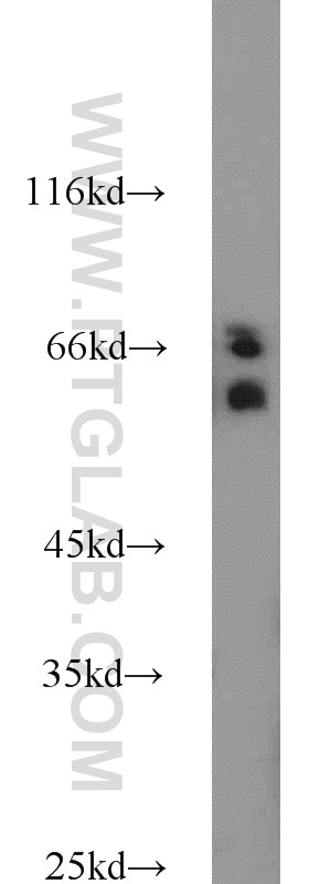 Western Blot (WB) analysis of mouse brain tissue using CDC25B Polyclonal antibody (10644-1-AP)