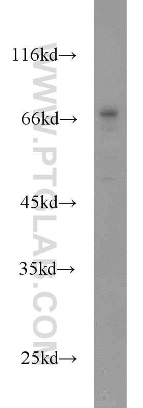 Western Blot (WB) analysis of Raji cells using CDC25B Polyclonal antibody (10644-1-AP)