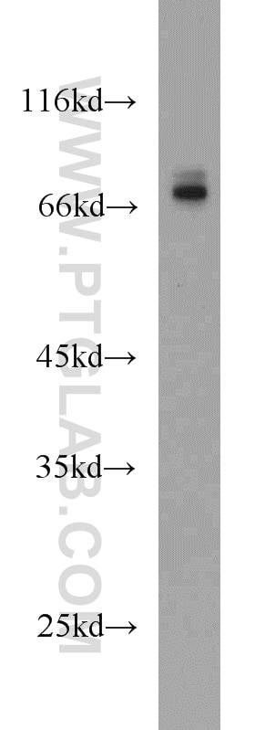 Western Blot (WB) analysis of mouse liver tissue using CDC25B Polyclonal antibody (10644-1-AP)