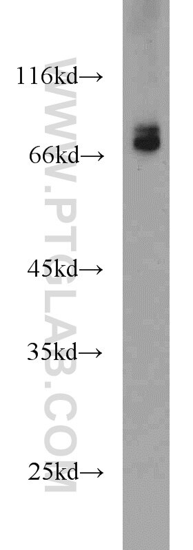 Western Blot (WB) analysis of mouse liver tissue using CDC25B Polyclonal antibody (10644-1-AP)