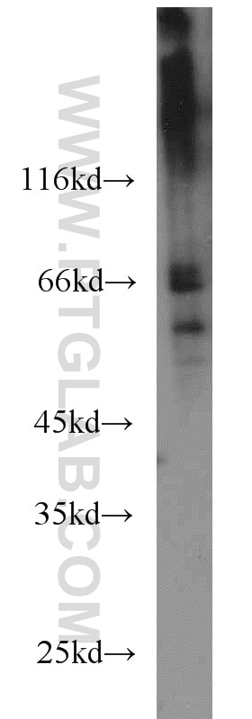 Western Blot (WB) analysis of Raji cells using CDC25B Polyclonal antibody (10644-1-AP)