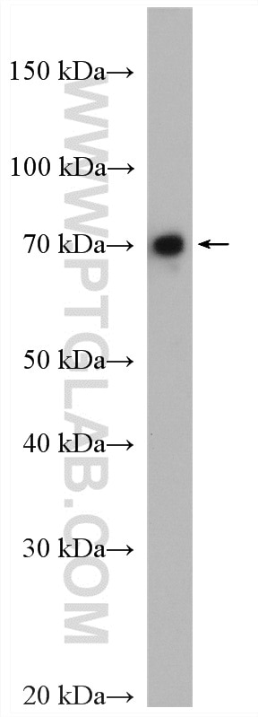 Western Blot (WB) analysis of HepG2 cells using CDC25B Polyclonal antibody (28109-1-AP)