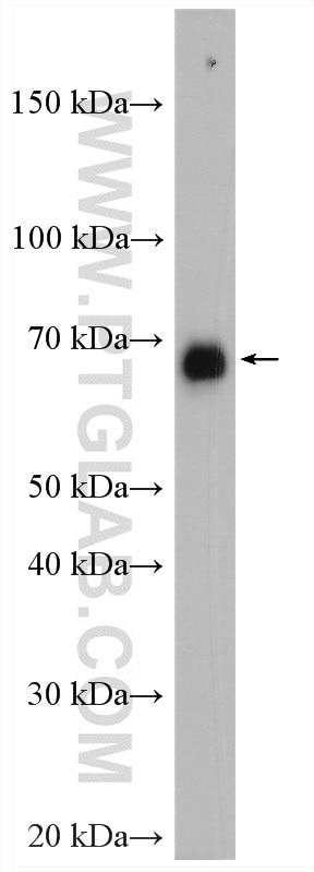 Western Blot (WB) analysis of HeLa cells using CDC25B Polyclonal antibody (28109-1-AP)