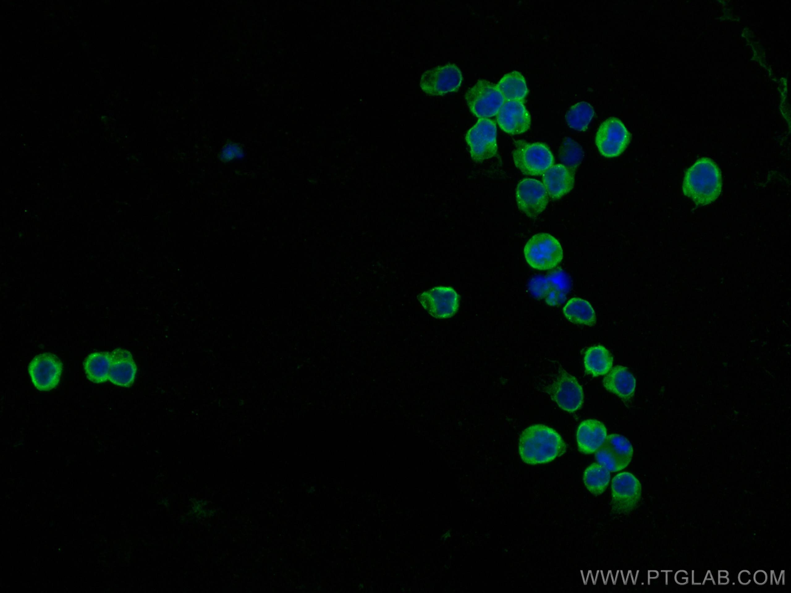 Immunofluorescence (IF) / fluorescent staining of Jurkat cells using CDC25B Monoclonal antibody (67145-1-Ig)