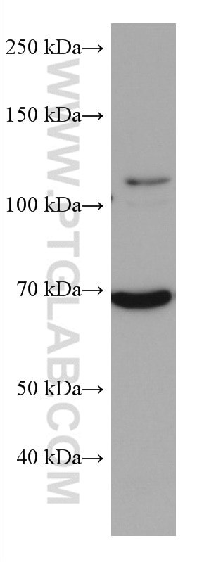 Western Blot (WB) analysis of Jurkat cells using CDC25B Monoclonal antibody (67145-1-Ig)