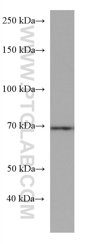 Western Blot (WB) analysis of U-937 cells using CDC25B Monoclonal antibody (67145-1-Ig)