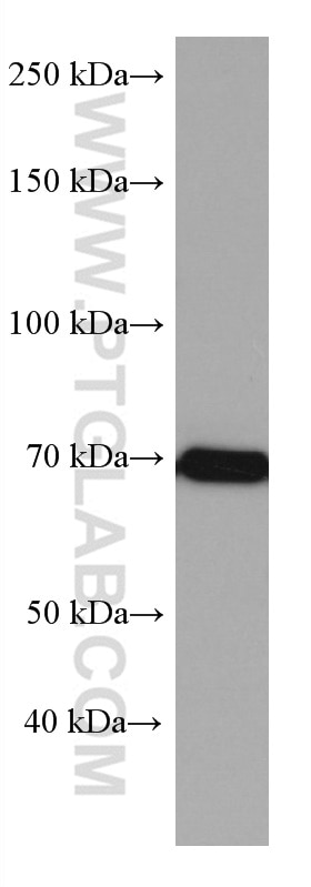 Western Blot (WB) analysis of Sp2/0 cells using CDC25B Monoclonal antibody (67145-1-Ig)