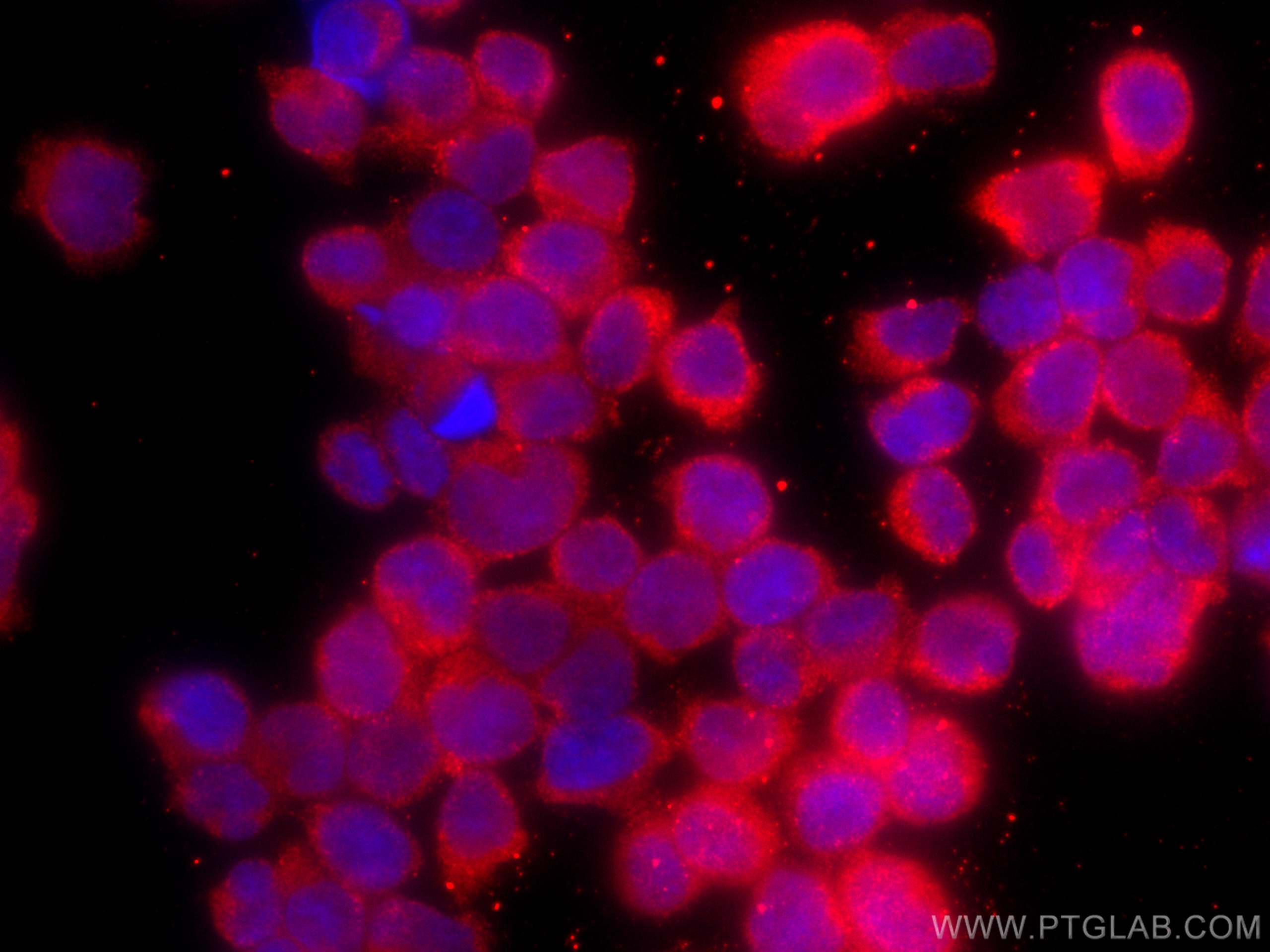 Immunofluorescence (IF) / fluorescent staining of Jurkat cells using CoraLite®594-conjugated CDC25B Monoclonal antibody (CL594-67145)