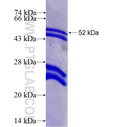 CDC25B fusion protein Ag27138 SDS-PAGE