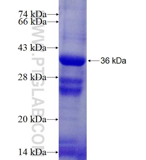 CDC25B fusion protein Ag27193 SDS-PAGE