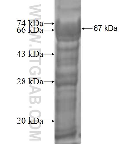 CDC25B fusion protein Ag0994 SDS-PAGE